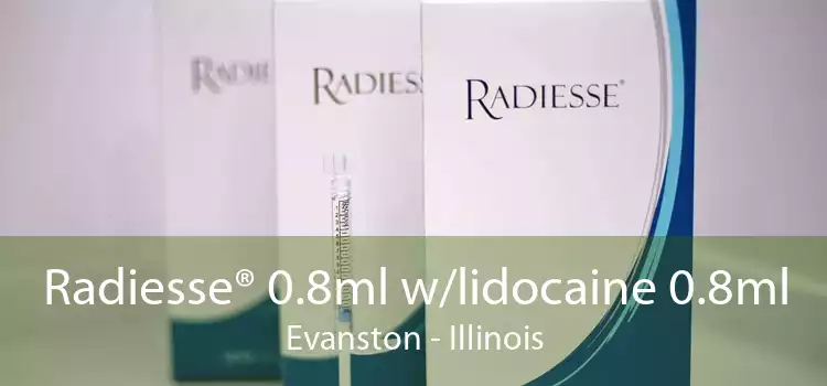 Radiesse® 0.8ml w/lidocaine 0.8ml Evanston - Illinois