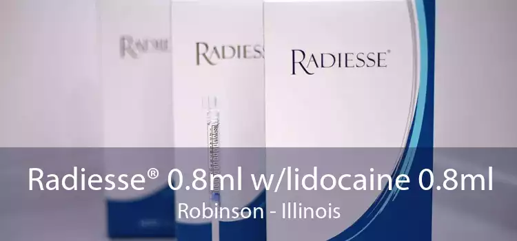 Radiesse® 0.8ml w/lidocaine 0.8ml Robinson - Illinois